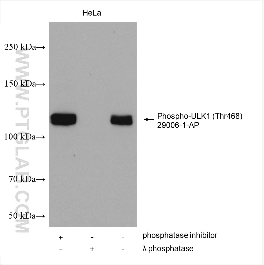 Western Blot (WB) analysis of various lysates using Phospho-ULK1 (Thr468) Polyclonal antibody (29006-1-AP)