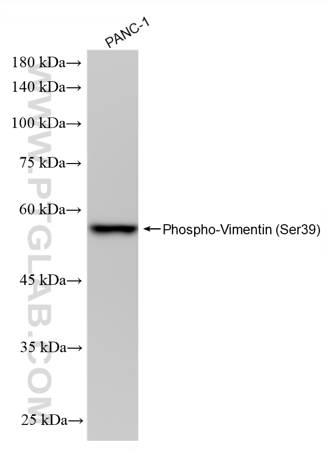 Western Blot (WB) analysis of PANC-1 cells using Phospho-Vimentin (Ser39) Recombinant monoclonal an (87714-1-RR)