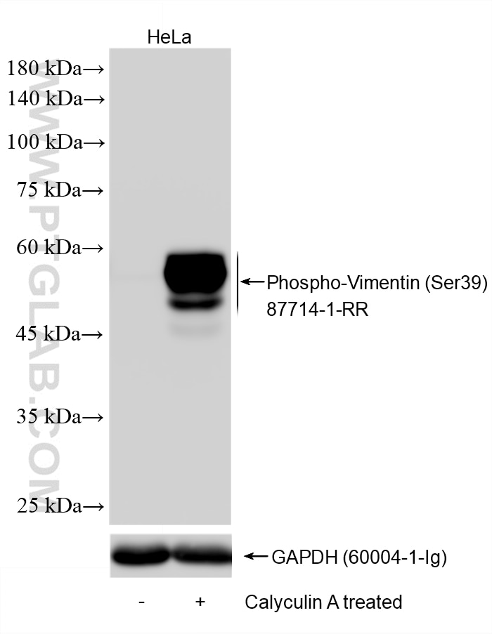 Western Blot (WB) analysis of various lysates using Phospho-Vimentin (Ser39) Recombinant monoclonal an (87714-1-RR)