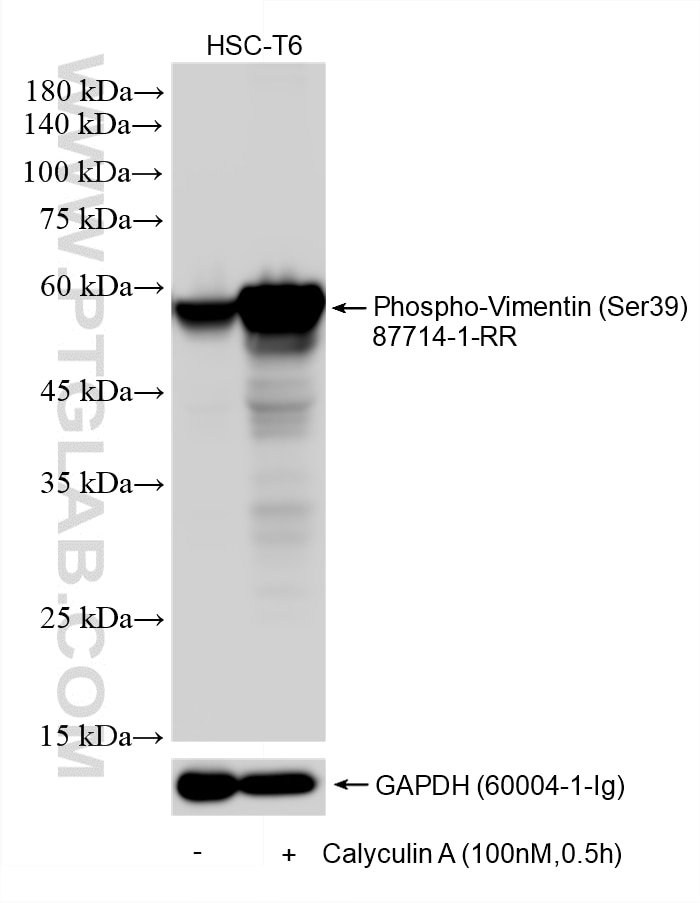 Western Blot (WB) analysis of various lysates using Phospho-Vimentin (Ser39) Recombinant monoclonal an (87714-1-RR)