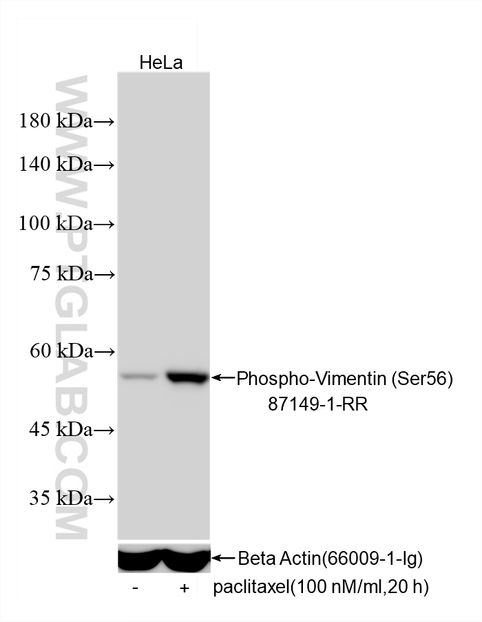 Non-treated HeLa cells and paclitaxel treated HeLa cells were subjected to SDS PAGE followed by western blot with 87149-1-RR (Phospho-Vimentin (Ser56) antibody) at dilution of 1:10000 incubated at room temperature for 1.5 hours. The membrane was stripped and re-blotted with Beta Actin (66009-1-Ig) antibody as a loading control. This data was developed using the same antibody clone with 87149-1-PBS in a different storage buffer formulation. Western Blot (WB) analysis of various lysates using Phospho-Vimentin (Ser56) Recombinant monoclonal an (87149-1-RR)