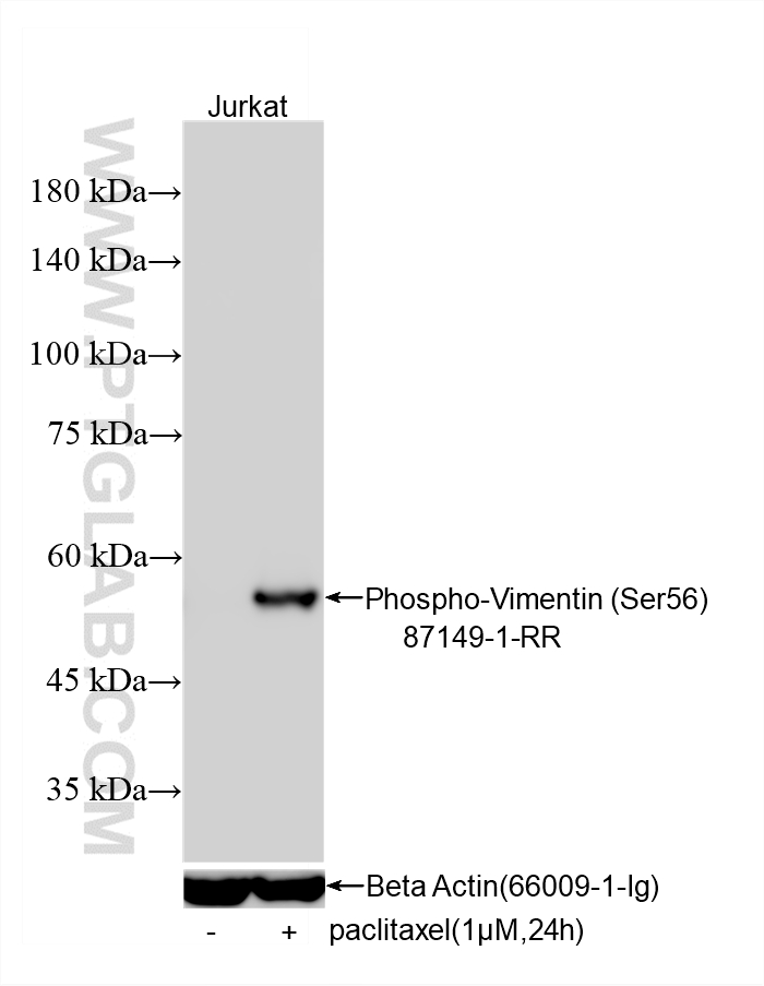Non-treated Jurkat cells and paclitaxel treated Jurkat cells were subjected to SDS PAGE followed by western blot with 87149-1-RR (Phospho-Vimentin (Ser56) antibody) at dilution of 1:10000 incubated at room temperature for 1.5 hours. The membrane was stripped and re-blotted with Beta Actin (66009-1-Ig) antibody as a loading control. This data was developed using the same antibody clone with 87149-1-PBS in a different storage buffer formulation. Western Blot (WB) analysis of various lysates using Phospho-Vimentin (Ser56) Recombinant monoclonal an (87149-1-RR)