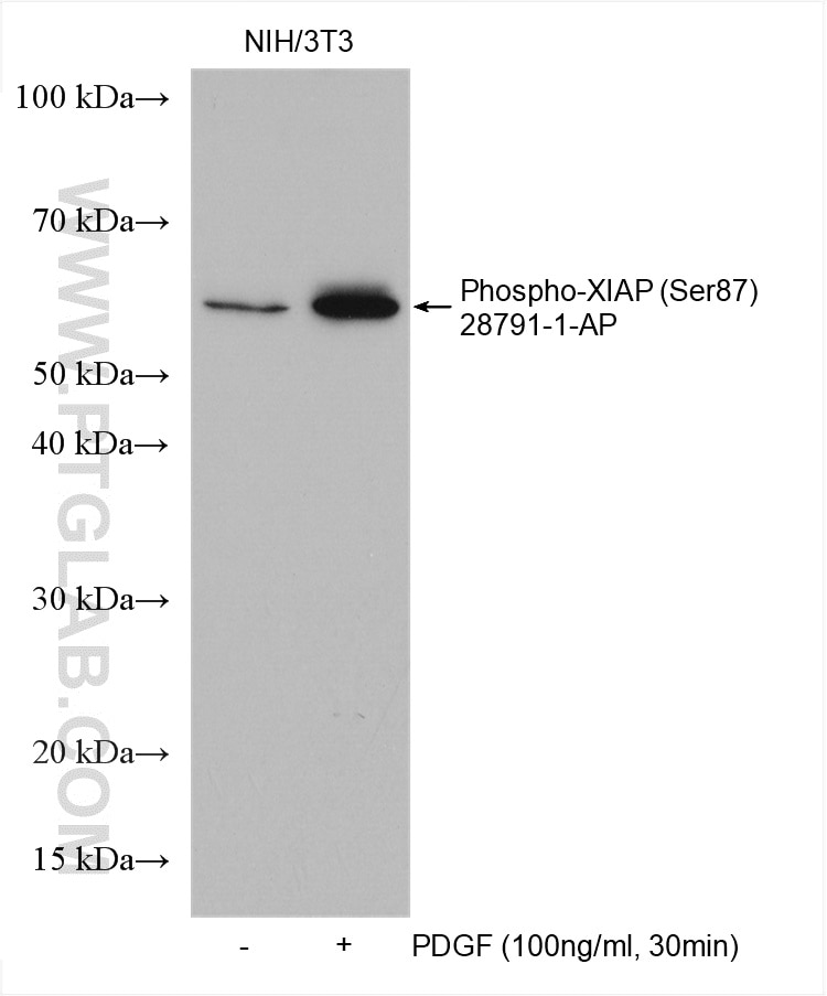 Phospho-XIAP (Ser87)