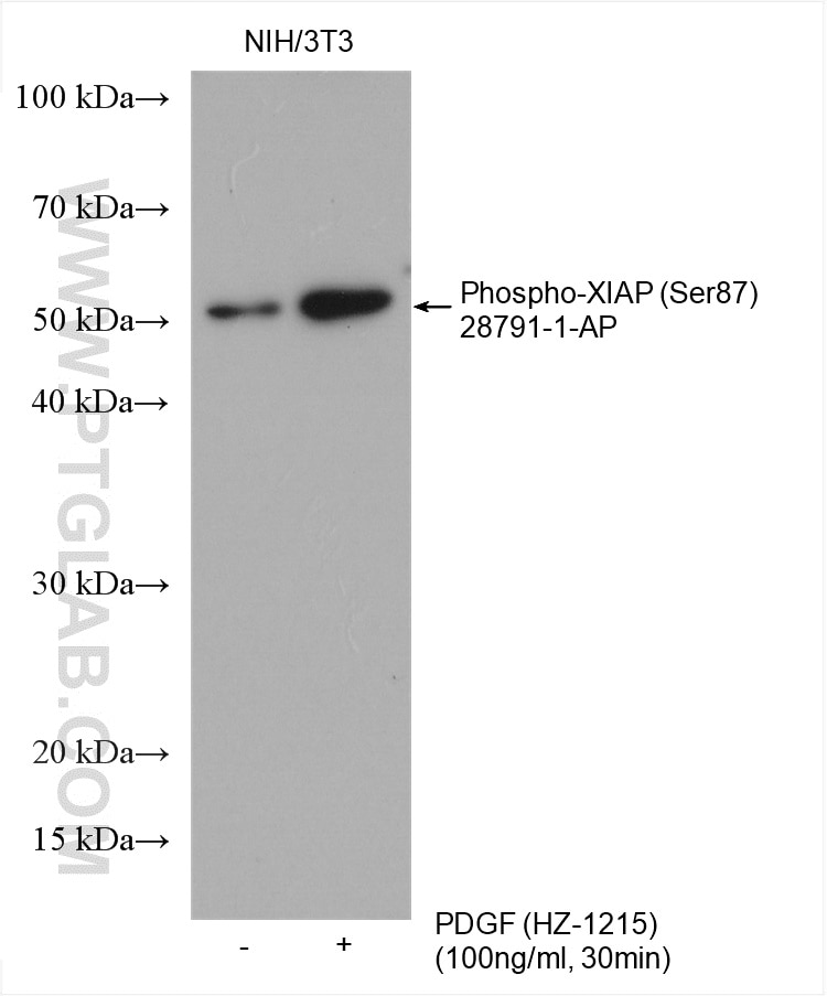 Western Blot (WB) analysis of various lysates using Phospho-XIAP (Ser87) Polyclonal antibody (28791-1-AP)
