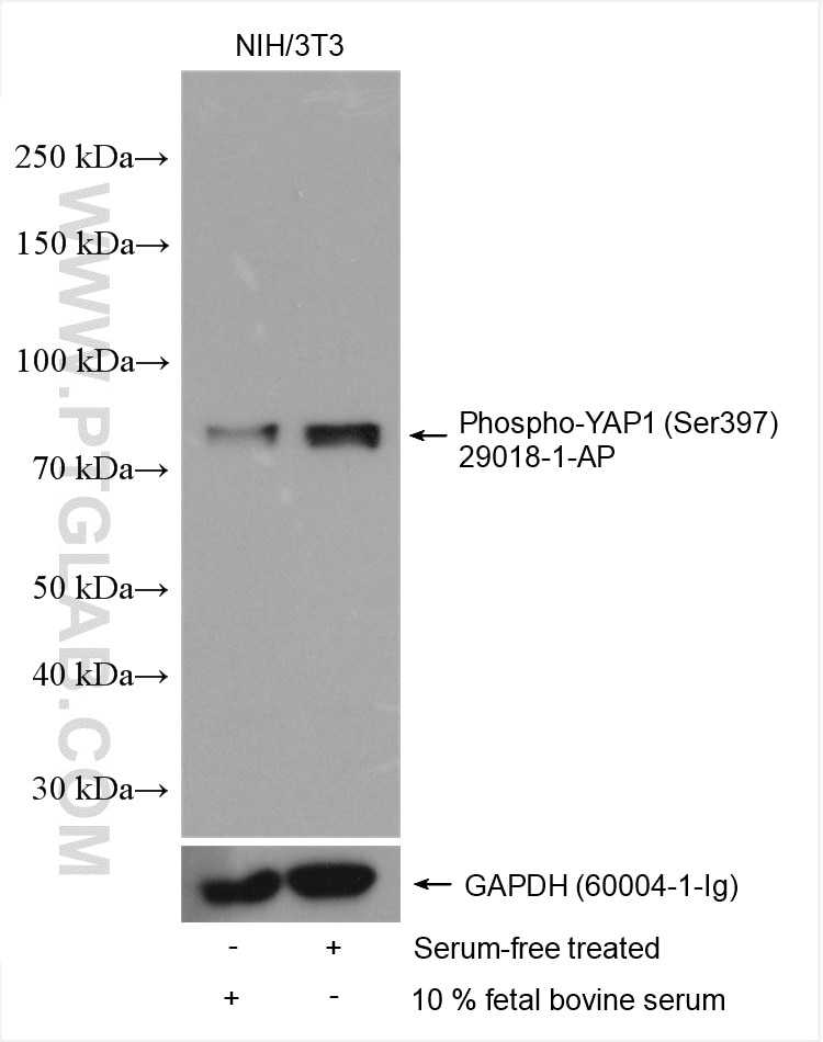 Western Blot (WB) analysis of various lysates using Phospho-YAP1 (Ser397) Polyclonal antibody (29018-1-AP)