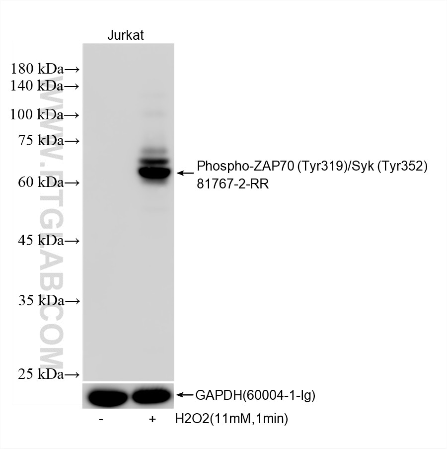 Western Blot (WB) analysis of Jurkat cells using Phospho-ZAP70 (Tyr319)/SYK (Tyr352) Recombinant mo (81767-2-RR)