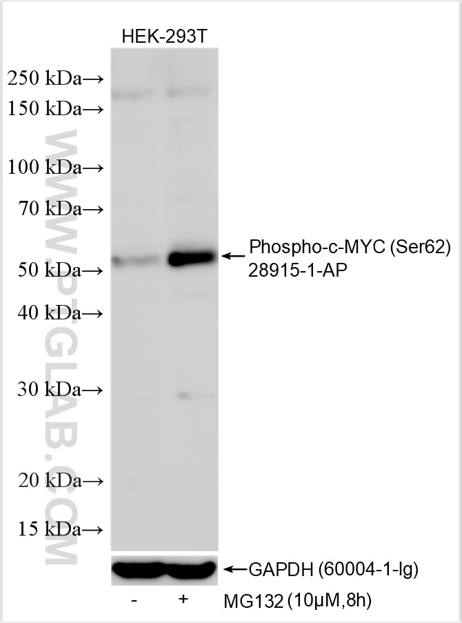 Western Blot (WB) analysis of various lysates using Phospho-c-MYC (Ser62) Polyclonal antibody (28915-1-AP)
