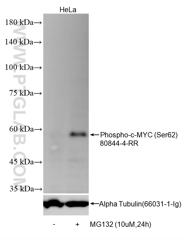 Non-treated HeLa cells and MG132 treated HeLa cells were subjected to SDS PAGE followed by western blot with 80844-4-RR (Phospho-c-MYC (Ser62) antibody) at dilution of 1:1000 incubated at room temperature for 1.5 hours. The membrane was stripped and re-blotted with Alpha Tubulin (66031-1-Ig) antibody as a loading control. Western Blot (WB) analysis of HeLa cells using Phospho-c-MYC (Ser62) Recombinant monoclonal antib (80844-4-RR)