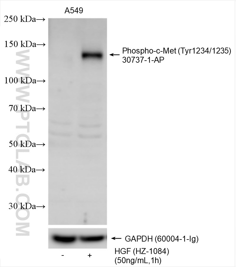Western Blot (WB) analysis of various lysates using Phospho-c-Met (Tyr1234/1235) Polyclonal antibody (30737-1-AP)