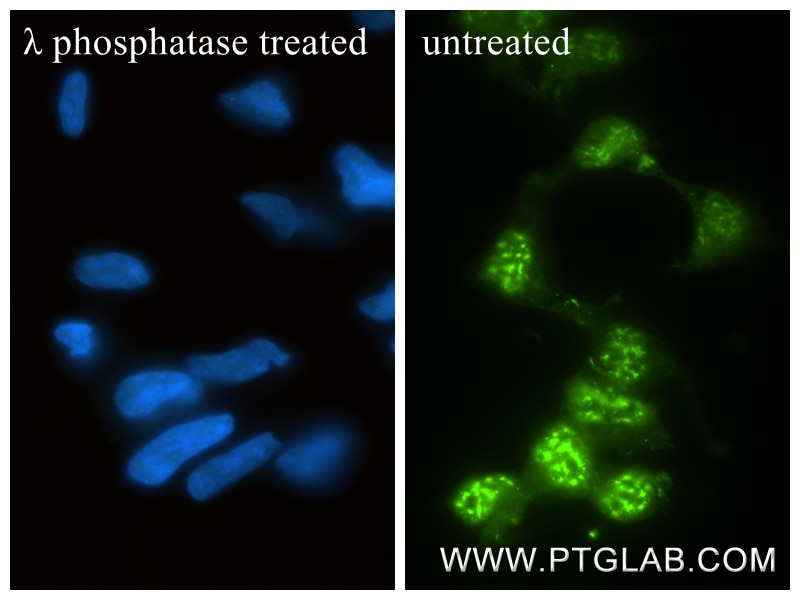 IF Staining of HEK-293 using 80706-3-RR Immunofluorescence (IF) / fluorescent staining of HEK-293 cells using Phospho-c-SRC (Ser17) Recombinant monoclonal antib (80706-3-RR)