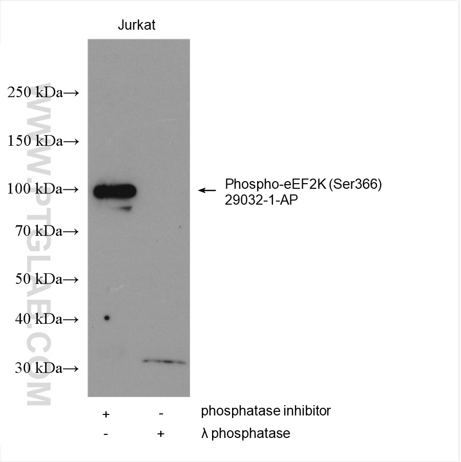 Western Blot (WB) analysis of various lysates using Phospho-eEF2K (Ser366) Polyclonal antibody (29032-1-AP)