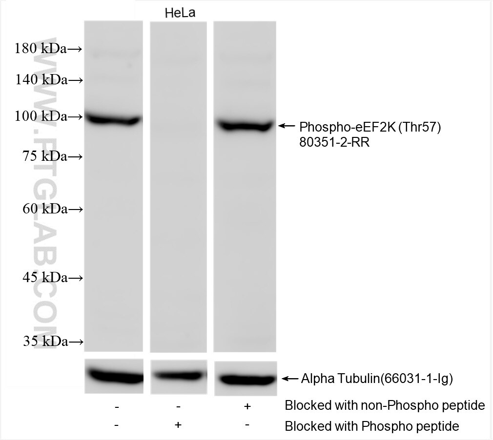 Phospho-eEF2K (Thr57)