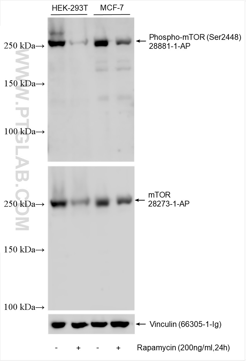 Western Blot (WB) analysis of various lysates using Phospho-mTOR (Ser2448) Polyclonal antibody (28881-1-AP)