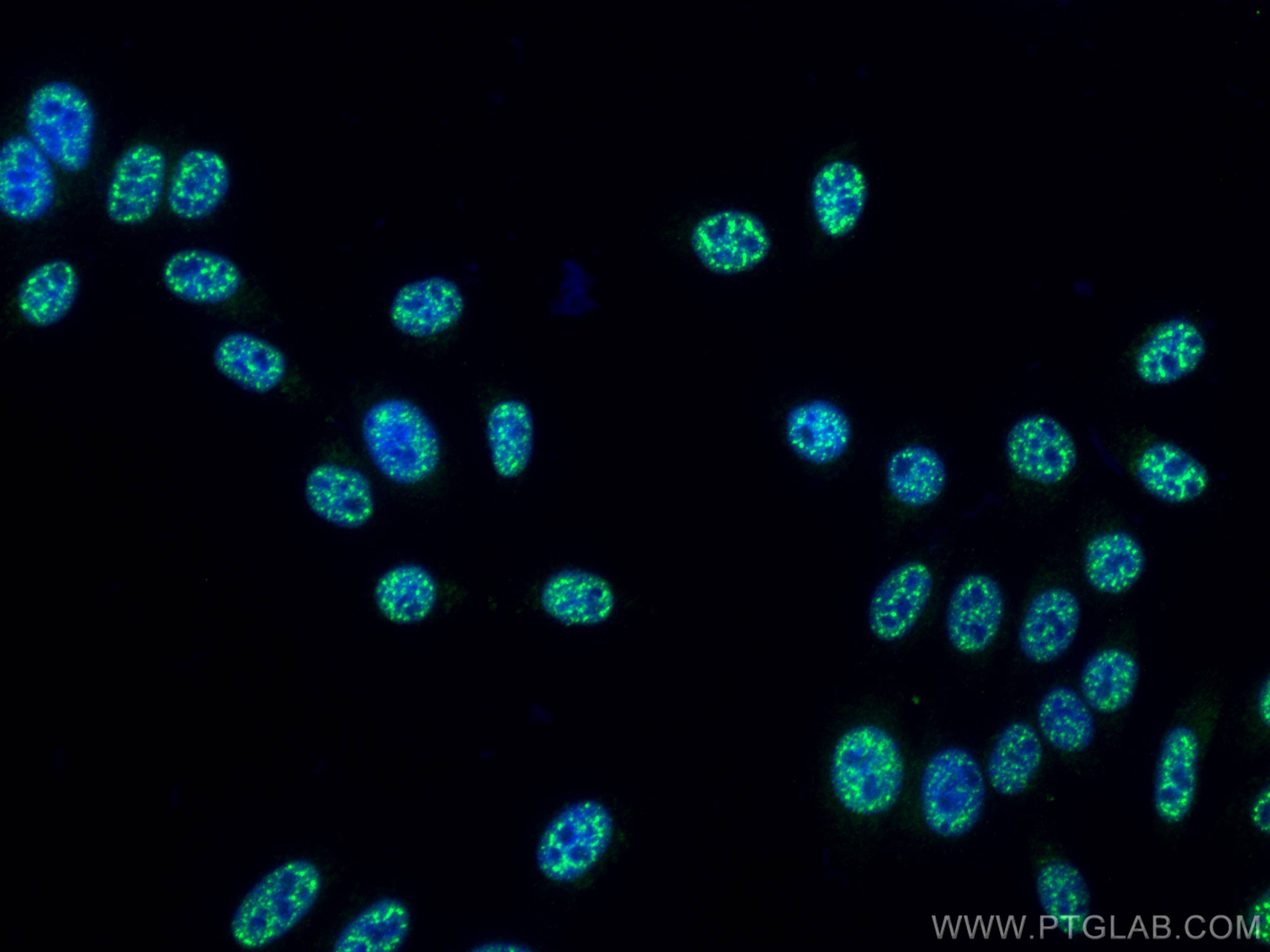 Immunofluorescence (IF) / fluorescent staining of HepG2 cells using Phospho-mTOR (Ser2448) Monoclonal antibody (67778-1-Ig)