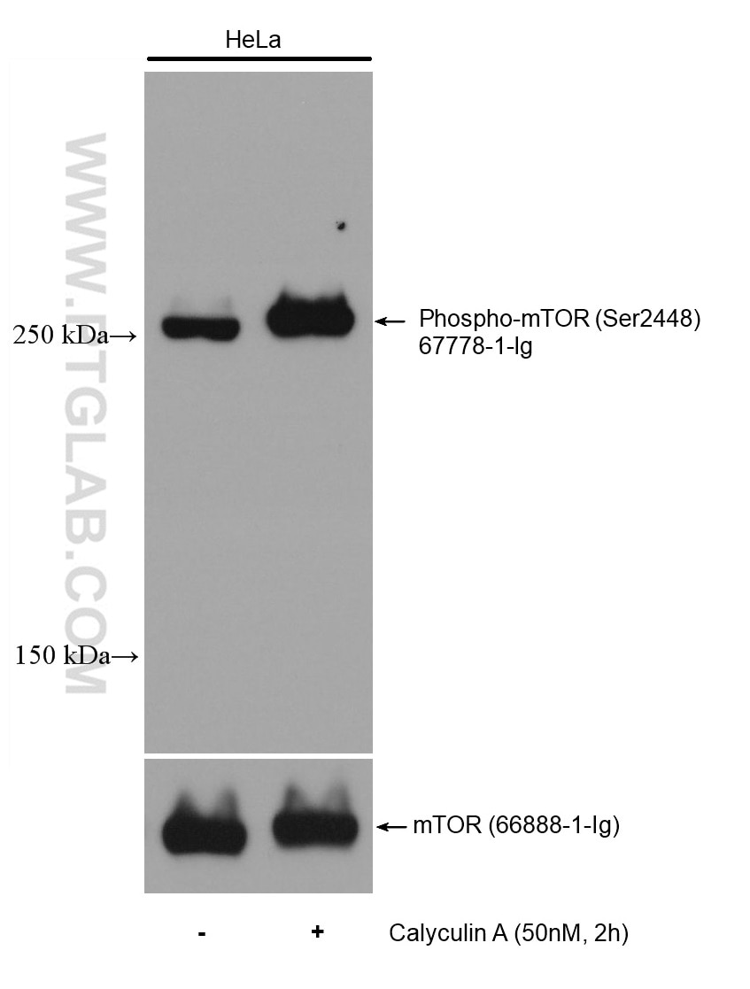 Western Blot (WB) analysis of various lysates using Phospho-mTOR (Ser2448) Monoclonal antibody (67778-1-Ig)