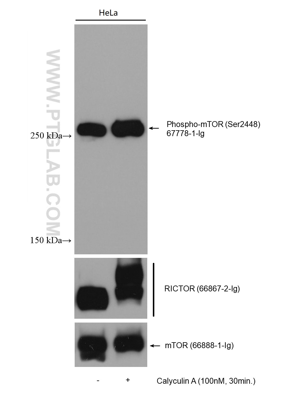 Western Blot (WB) analysis of various lysates using Phospho-mTOR (Ser2448) Monoclonal antibody (67778-1-Ig)