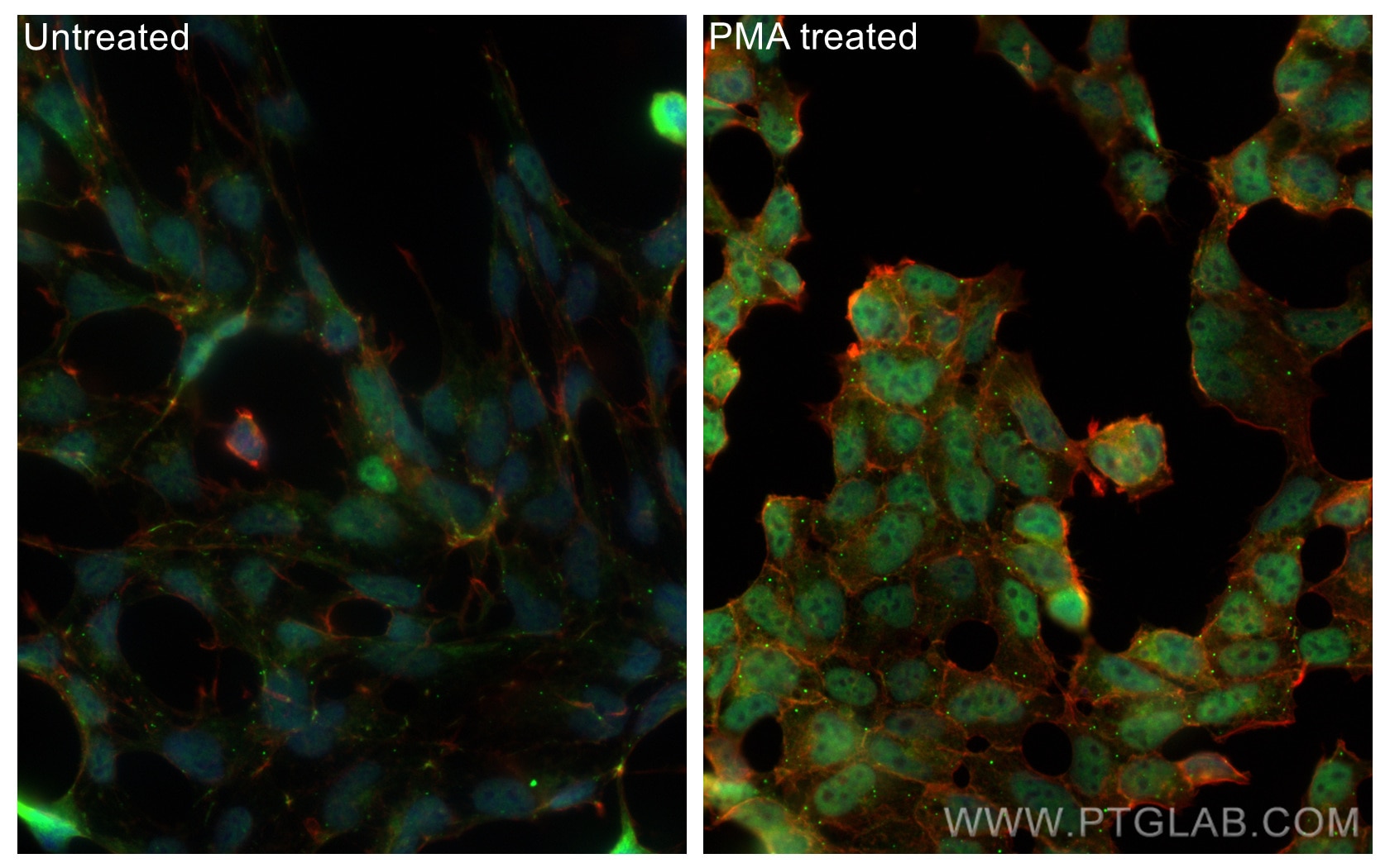 Immunofluorescence (IF) / fluorescent staining of HEK-293 cells using human Phospho-mTOR (Ser2448) Recombinant antibody (80596-1-RR)