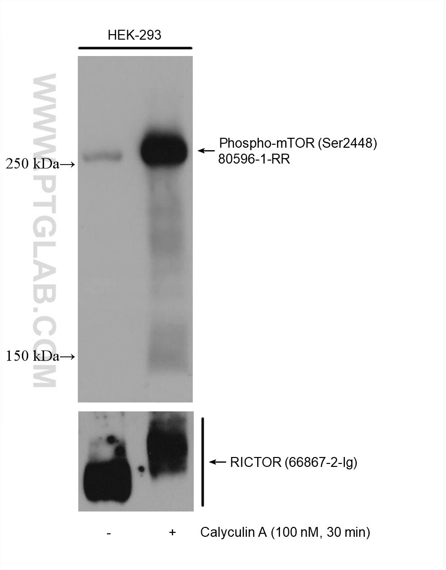 Western Blot (WB) analysis of various lysates using Phospho-mTOR (Ser2448) Recombinant antibody (80596-1-RR)