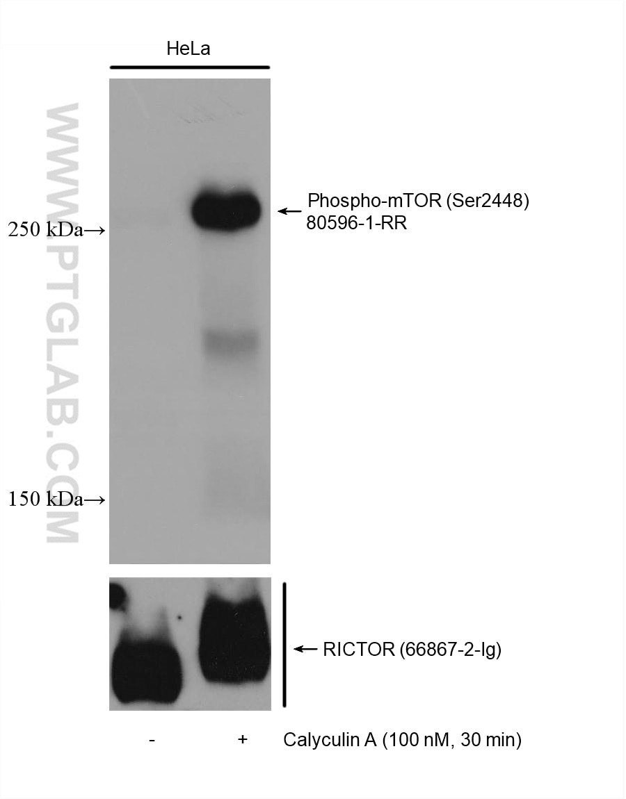 Western Blot (WB) analysis of various lysates using Phospho-mTOR (Ser2448) Recombinant antibody (80596-1-RR)