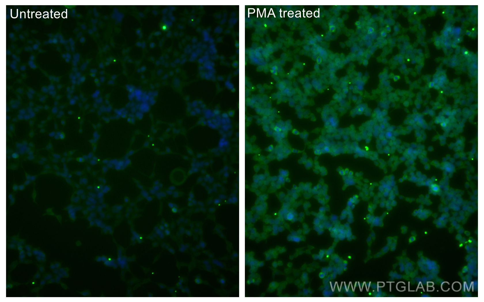 Immunofluorescence (IF) / fluorescent staining of HEK-293 cells using CoraLite® Plus 488-conjugated Phospho-mTOR (Ser244 (CL488-80596)