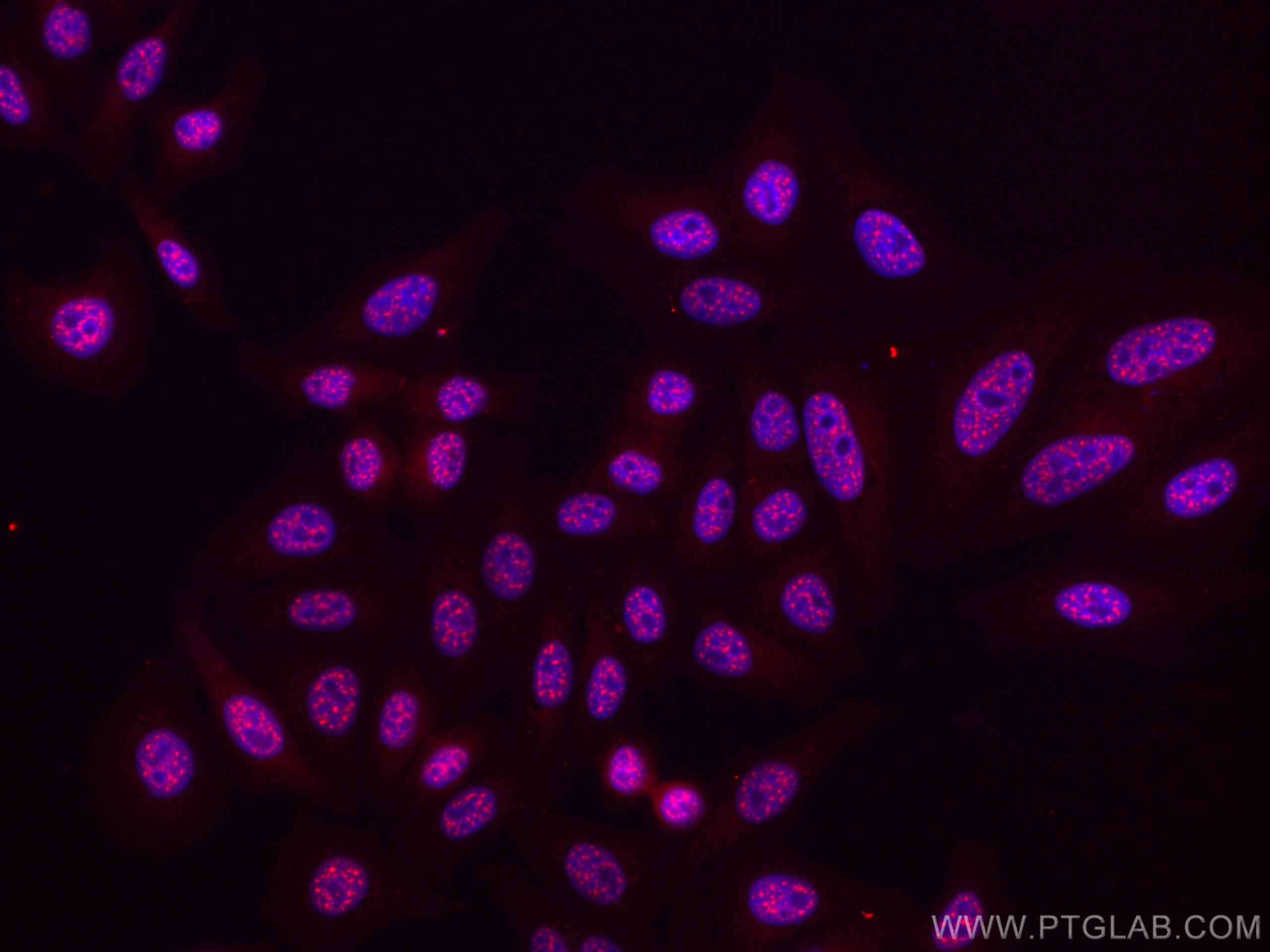 Immunofluorescence (IF) / fluorescent staining of HepG2 cells using CoraLite®594-conjugated Phospho-mTOR (Ser2448) Mon (CL594-67778)