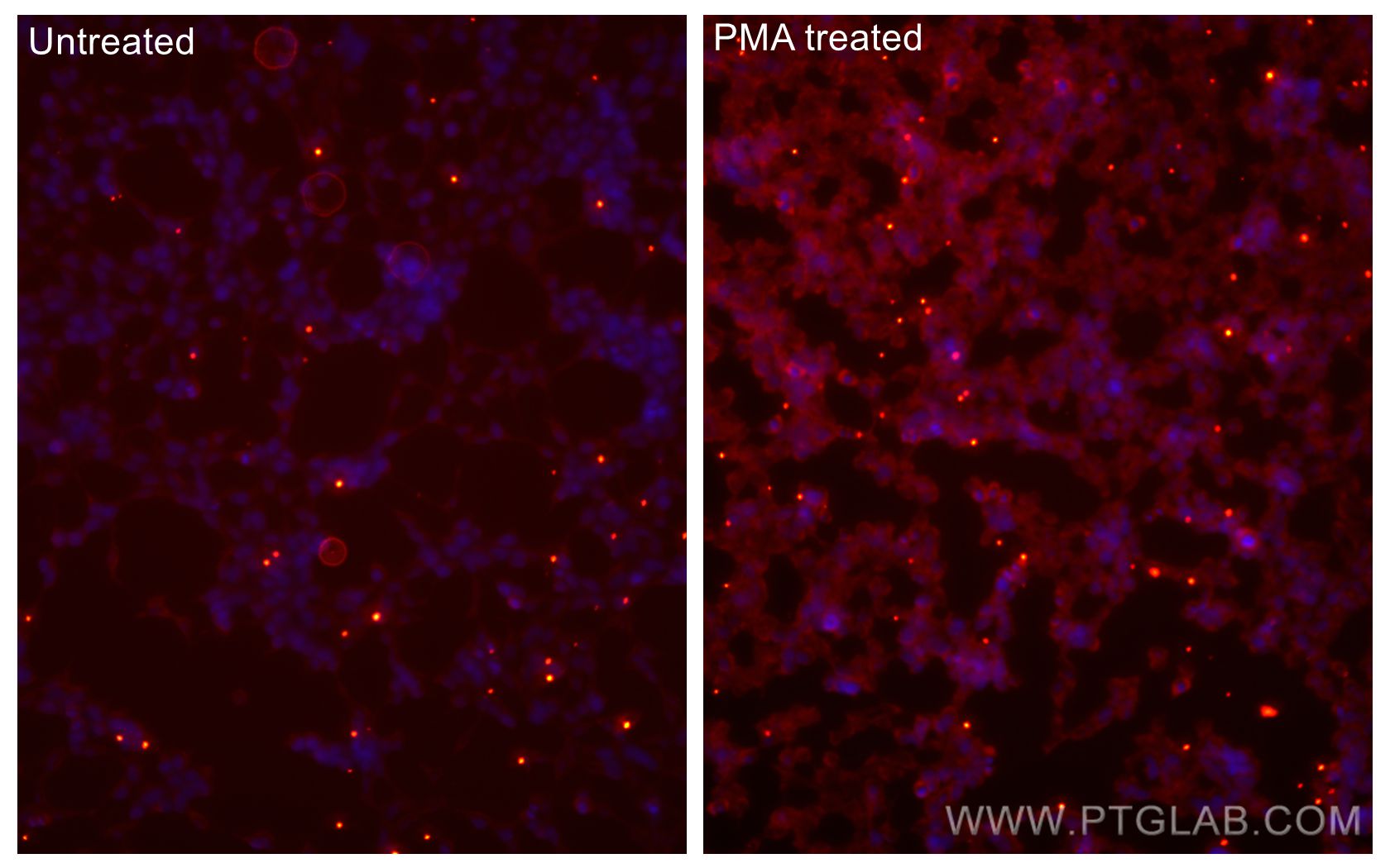Immunofluorescence (IF) / fluorescent staining of HEK-293 cells using CoraLite®594-conjugated Phospho-mTOR (Ser2448) Rec (CL594-80596)