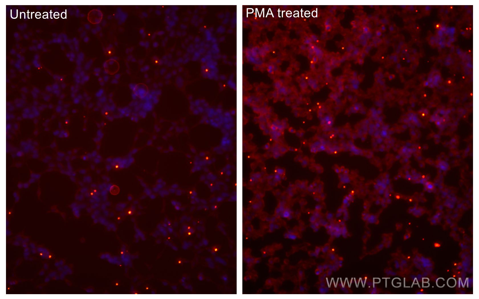 IF Staining of HEK-293 using CL594-80596