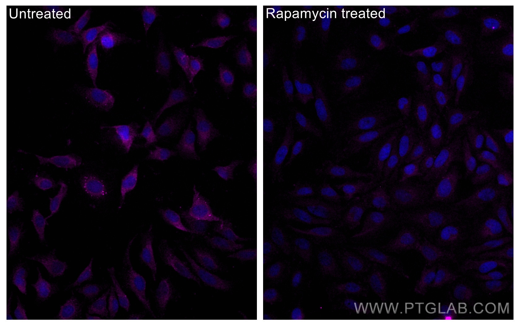 Immunofluorescence (IF) / fluorescent staining of HeLa cells using CoraLite® Plus 647-conjugated Phospho-mTOR (Ser244 (CL647-80596)