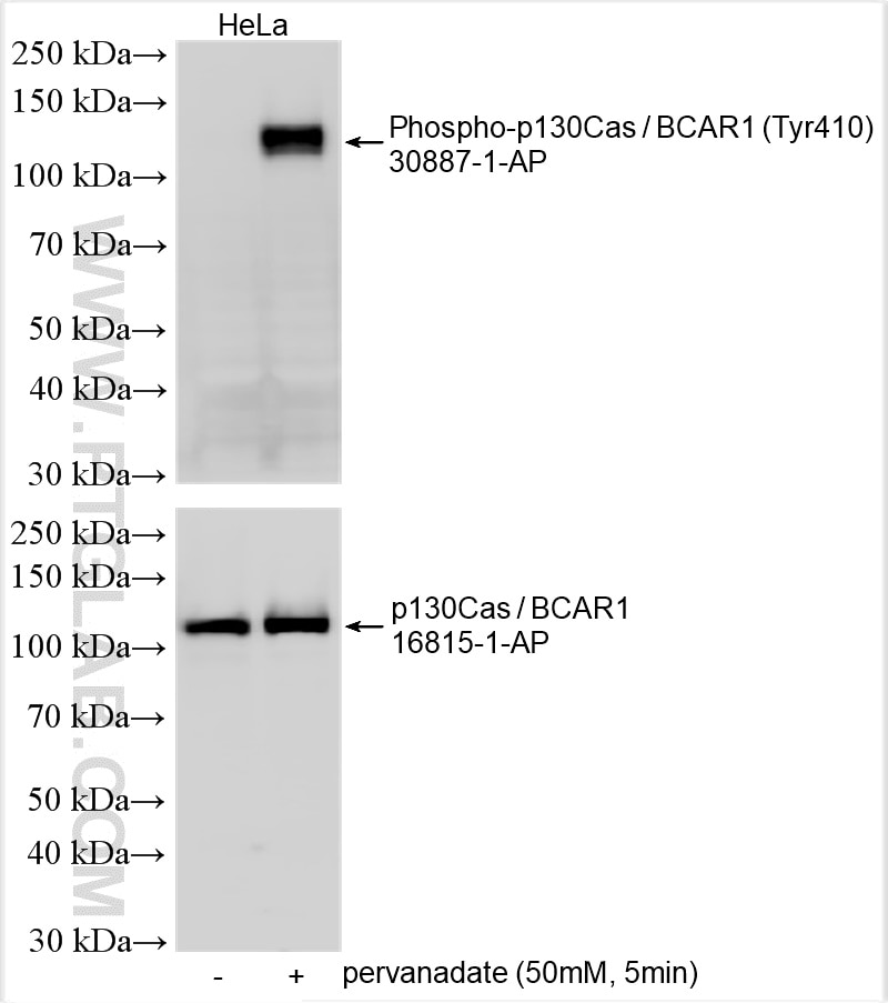 Western Blot (WB) analysis of various lysates using Phospho-p130Cas / BCAR1 (Tyr410) Polyclonal antibo (30887-1-AP)