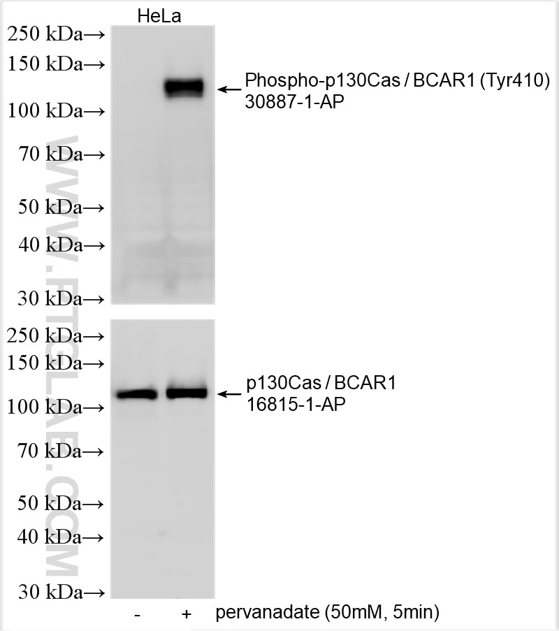 WB analysis using 30887-1-AP