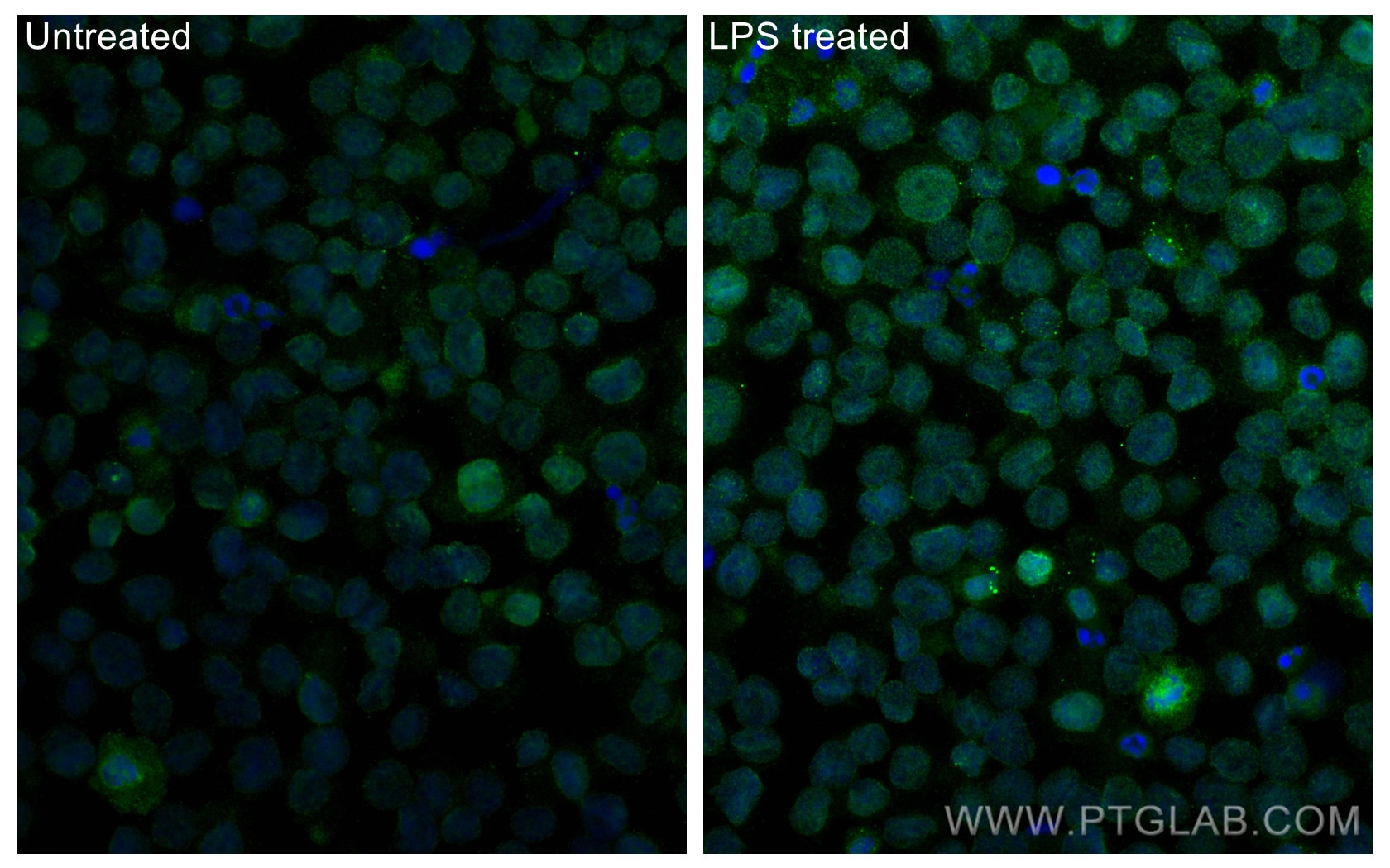 Immunofluorescence (IF) / fluorescent staining of THP-1 cells using Phospho-p38 MAPK (Thr180/Tyr182) Polyclonal antibo (28796-1-AP)