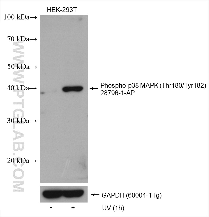 Western Blot (WB) analysis of various lysates using Phospho-p38 MAPK (Thr180/Tyr182) Polyclonal antibo (28796-1-AP)