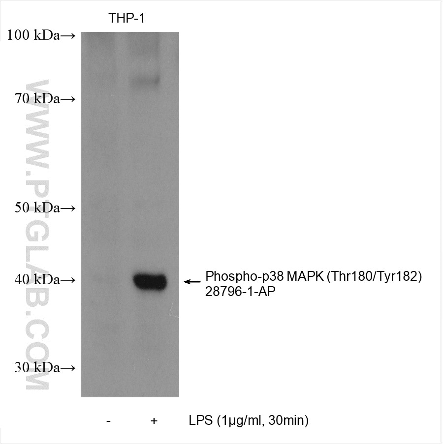 Western Blot (WB) analysis of various lysates using Phospho-p38 MAPK (Thr180/Tyr182) Polyclonal antibo (28796-1-AP)