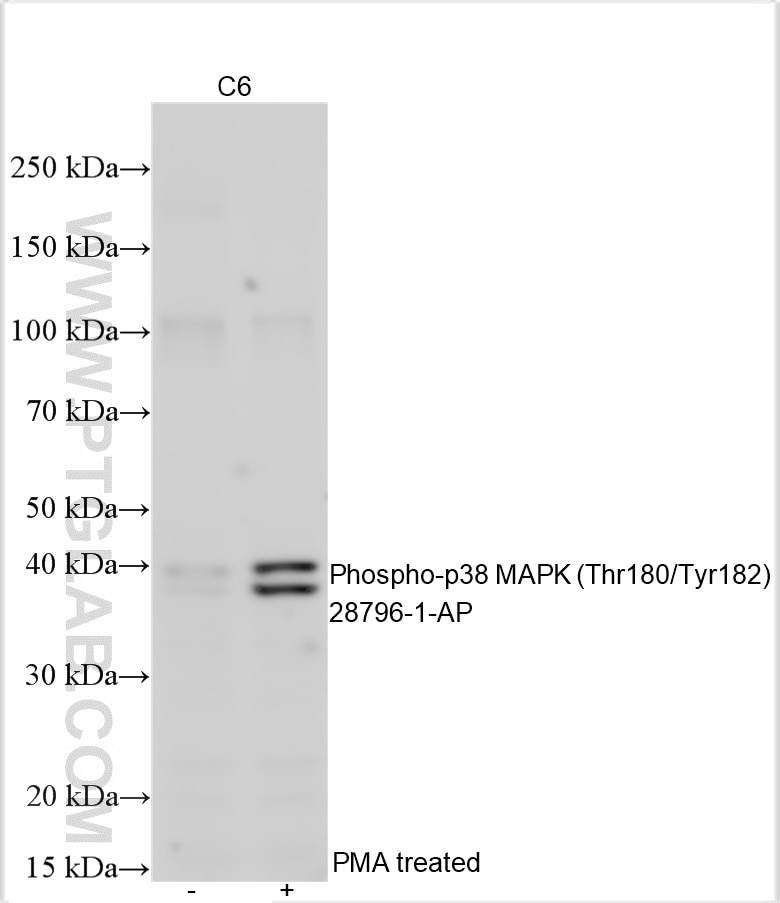 Western Blot (WB) analysis of various lysates using Phospho-p38 MAPK (Thr180/Tyr182) Polyclonal antibo (28796-1-AP)
