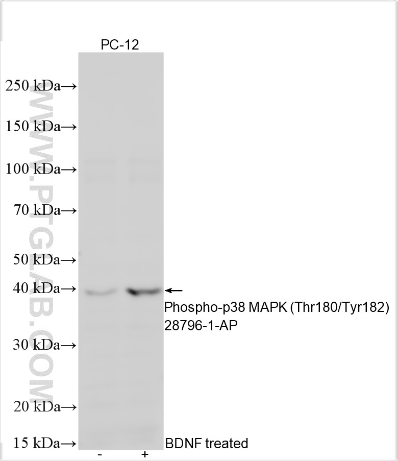 Western Blot (WB) analysis of various lysates using Phospho-p38 MAPK (Thr180/Tyr182) Polyclonal antibo (28796-1-AP)