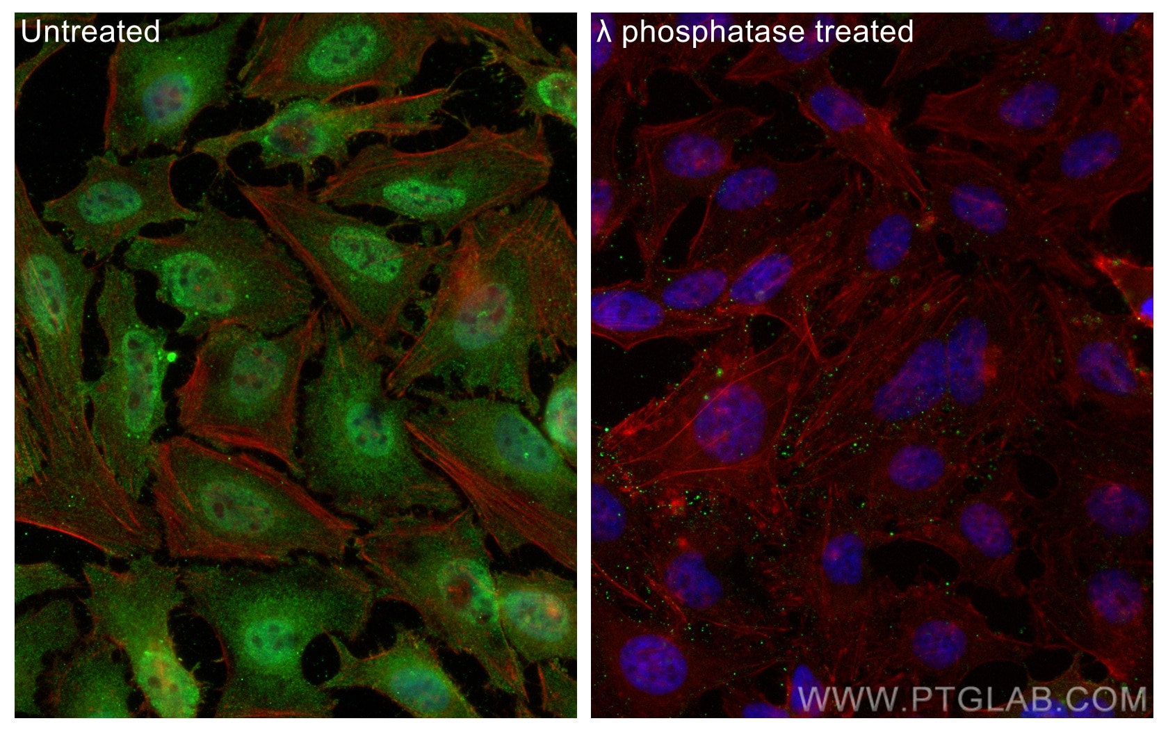 Immunofluorescence (IF) / fluorescent staining of HeLa cells using Phospho-p70(S6K) (Thr229) Polyclonal antibody (28988-1-AP)