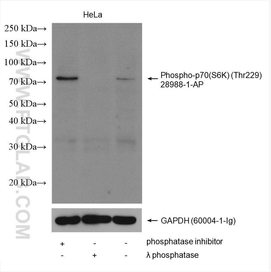 Western Blot (WB) analysis of various lysates using Phospho-p70(S6K) (Thr229) Polyclonal antibody (28988-1-AP)