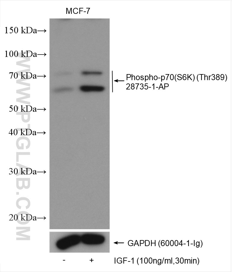 Western Blot (WB) analysis of various lysates using Phospho-p70(S6K) (Thr389) Polyclonal antibody (28735-1-AP)