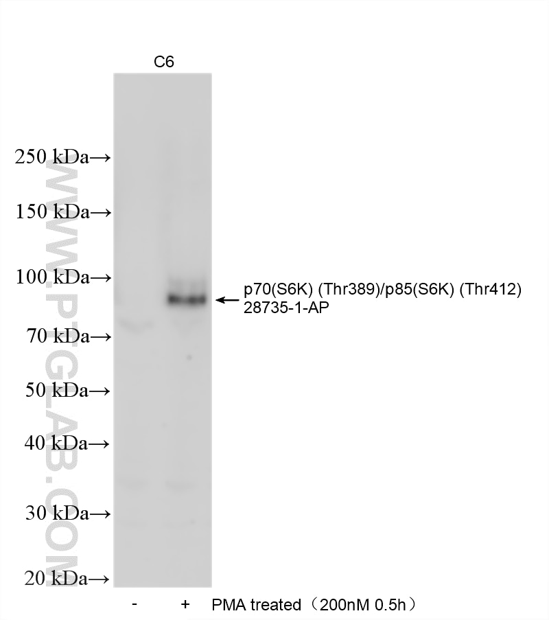 Western Blot (WB) analysis of various lysates using Phospho-p70(S6K) (Thr389)/p85(S6K) (Thr412) Polycl (28735-1-AP)