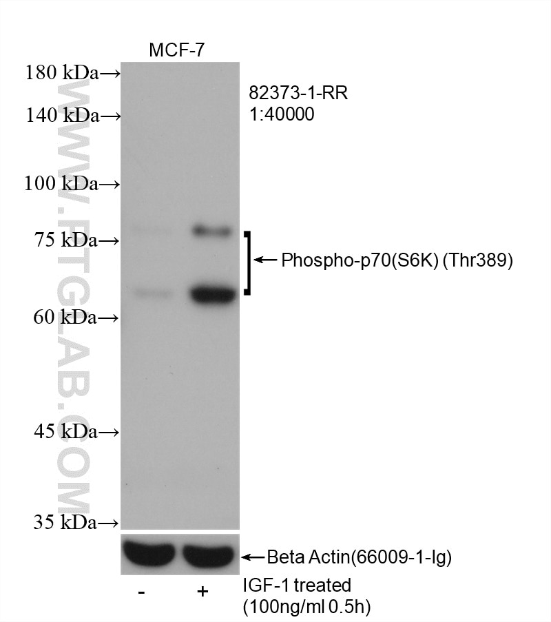 Phospho-p70(S6K) (Thr389)