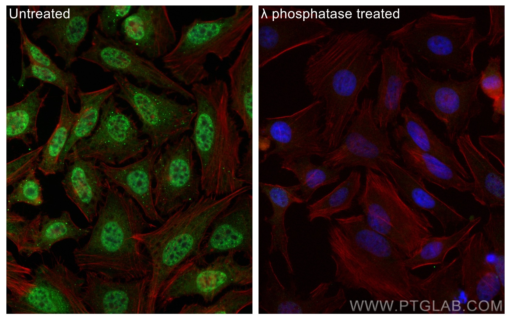Immunofluorescence (IF) / fluorescent staining of HeLa cells using Phospho-p70(S6K) (Thr421/Ser424) Polyclonal antibo (29248-1-AP)