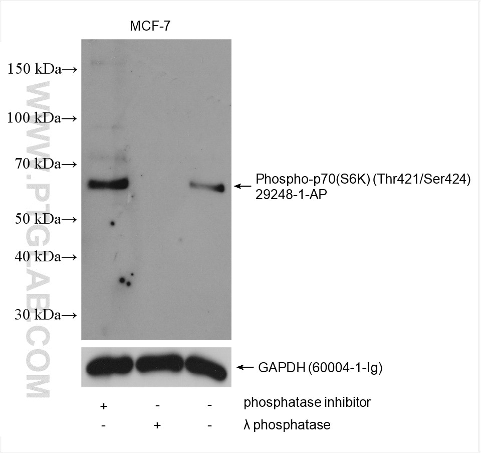 Western Blot (WB) analysis of various lysates using Phospho-p70(S6K) (Thr421/Ser424) Polyclonal antibo (29248-1-AP)