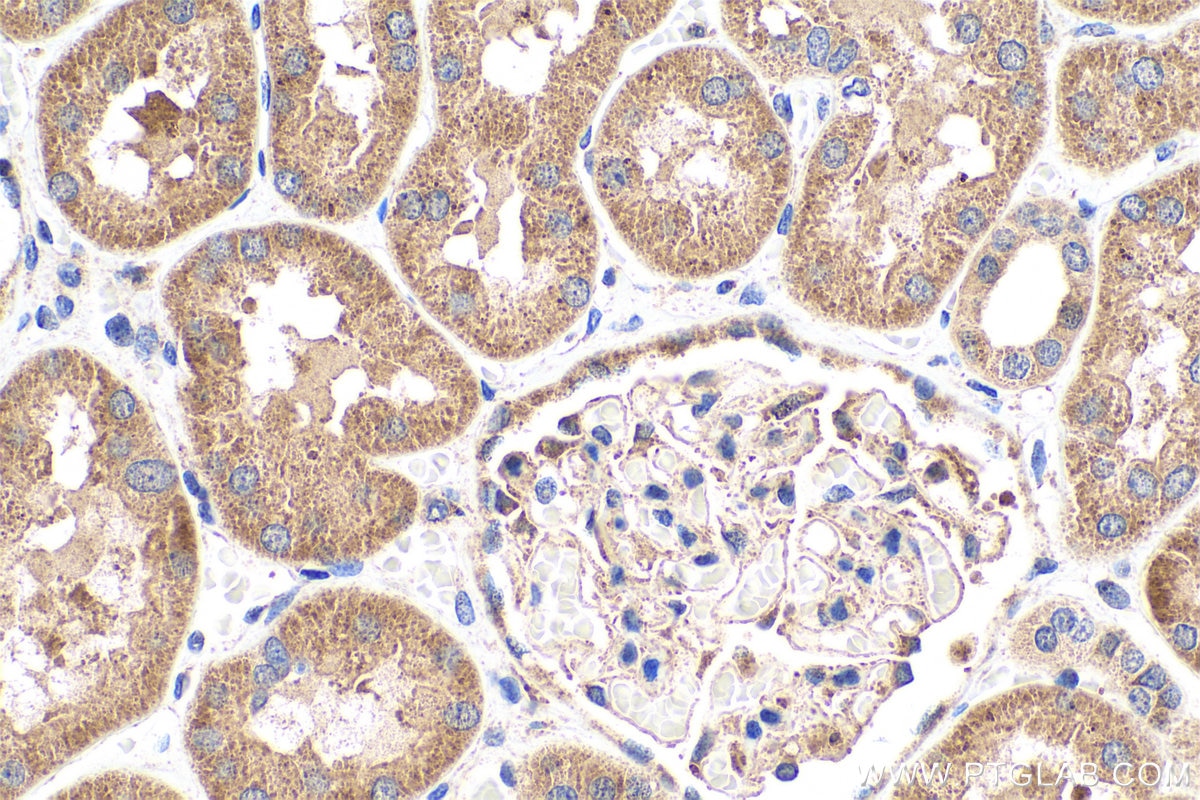 Immunohistochemistry (IHC) staining of human kidney tissue using Phospholipase C epsilon 1 Polyclonal antibody (55463-1-AP)