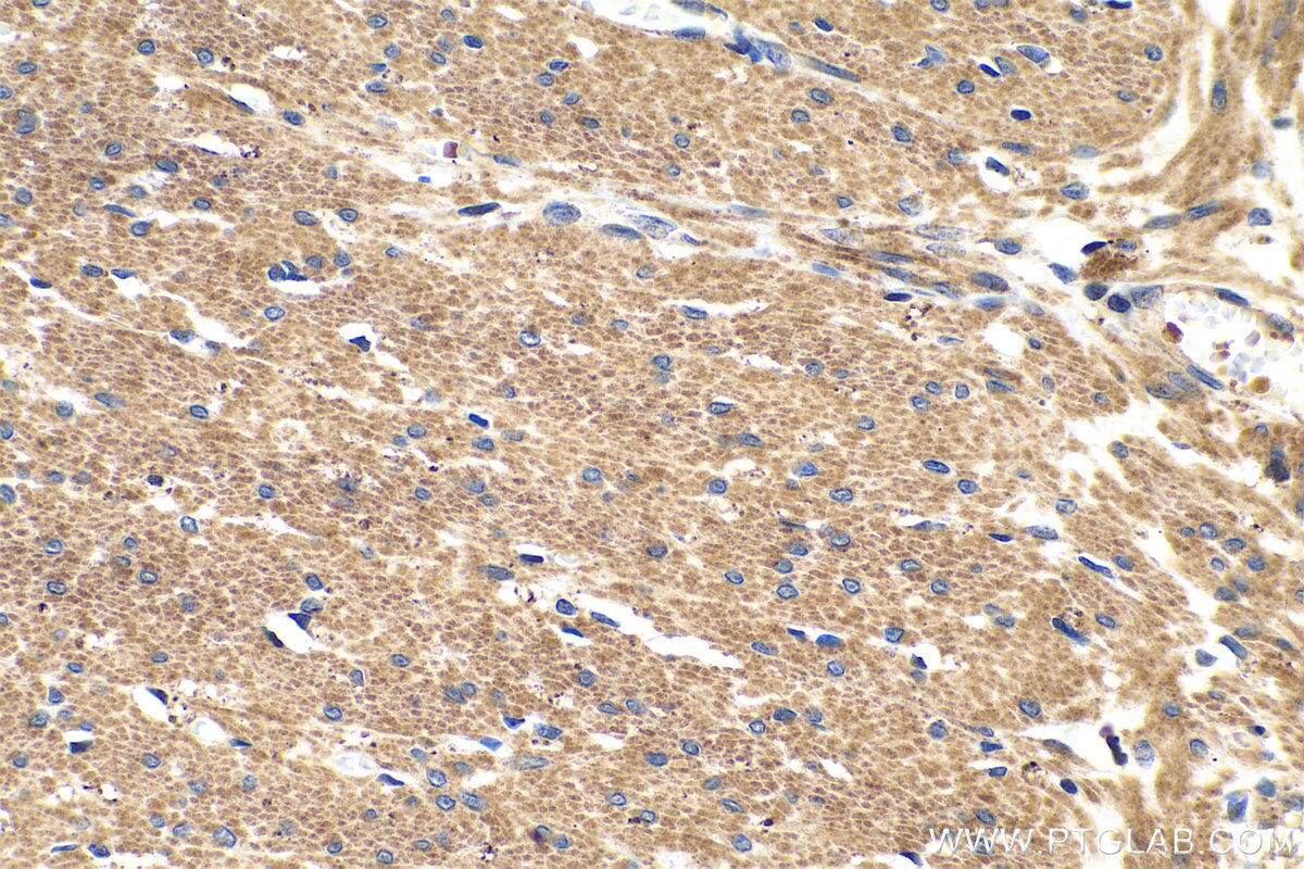 Immunohistochemistry (IHC) staining of human colon tissue using Phospholipase C epsilon 1 Polyclonal antibody (55463-1-AP)