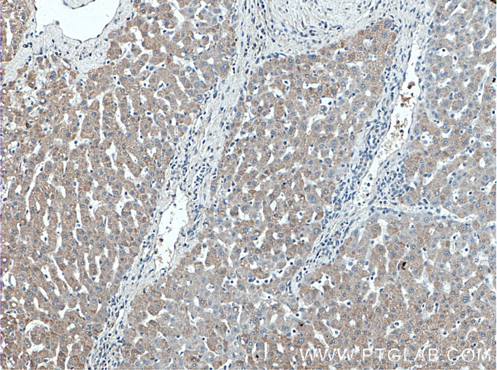 IHC staining of human liver using 26205-1-AP