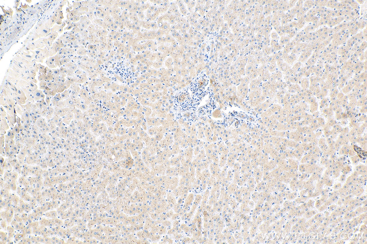 Immunohistochemistry (IHC) staining of human liver tissue using Piezo2 Polyclonal antibody (26205-1-AP)