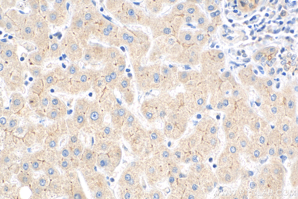 Immunohistochemistry (IHC) staining of human liver tissue using Piezo2 Polyclonal antibody (26205-1-AP)