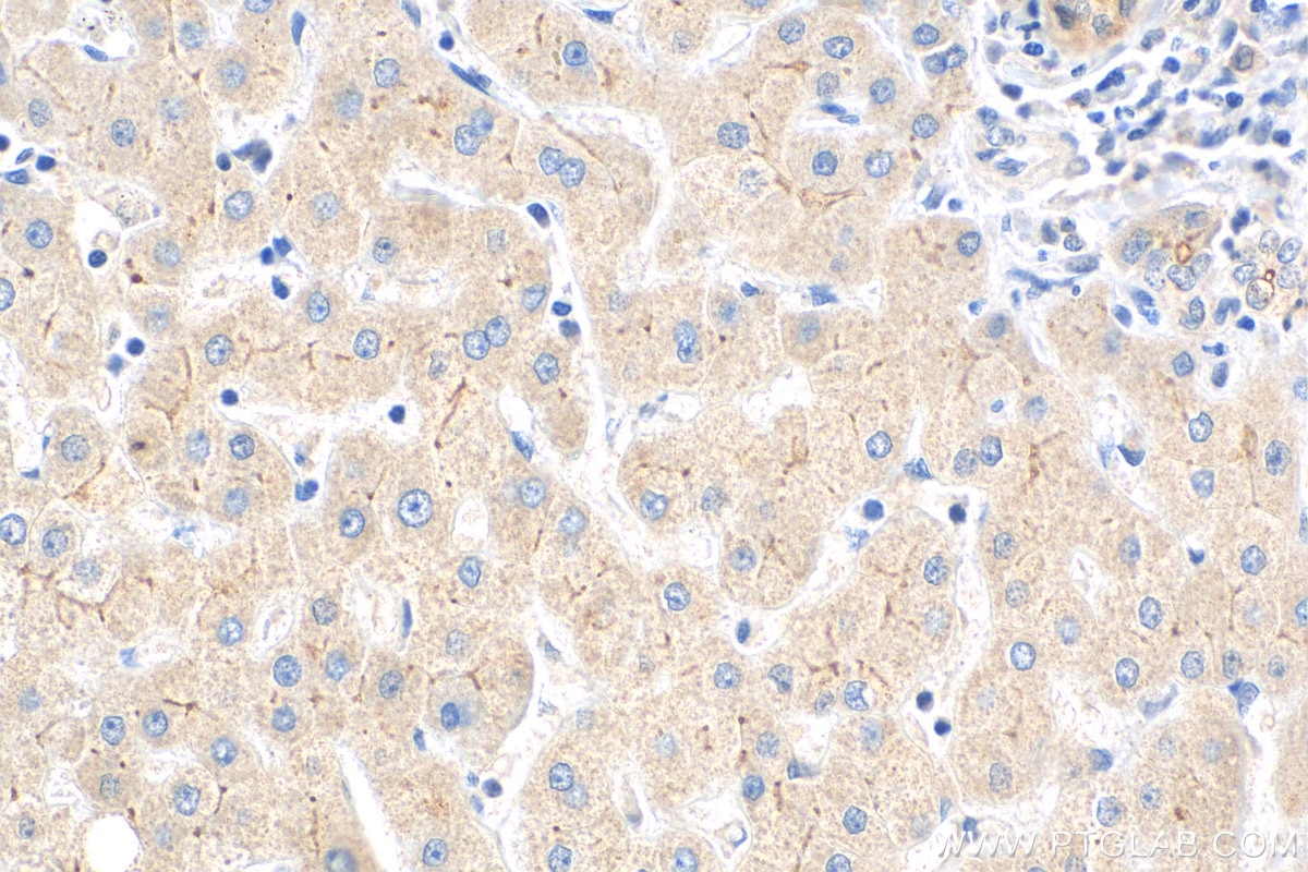 IHC staining of human liver using 26205-1-AP