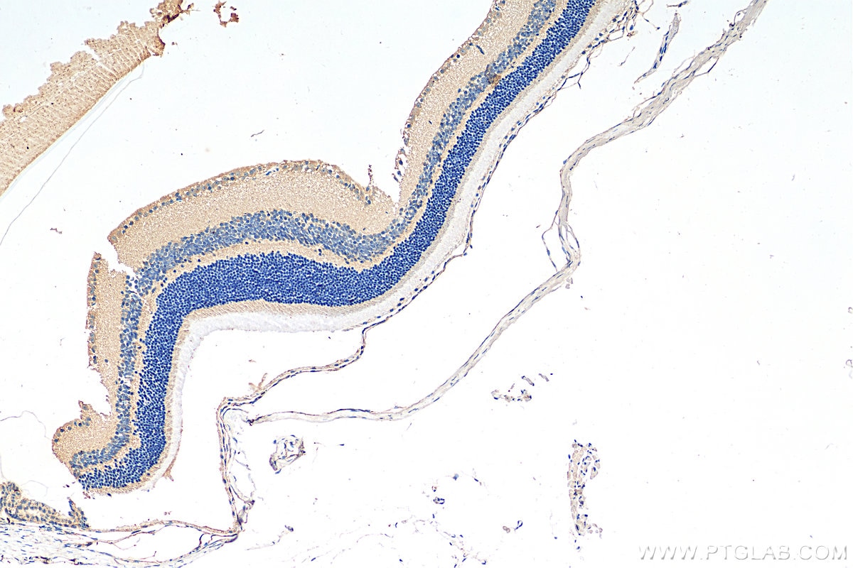 Immunohistochemistry (IHC) staining of mouse eye tissue using Piezo2 Polyclonal antibody (26205-1-AP)