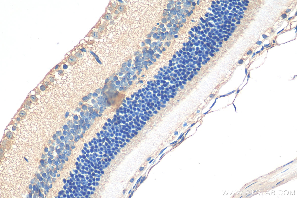 Immunohistochemistry (IHC) staining of mouse eye tissue using Piezo2 Polyclonal antibody (26205-1-AP)